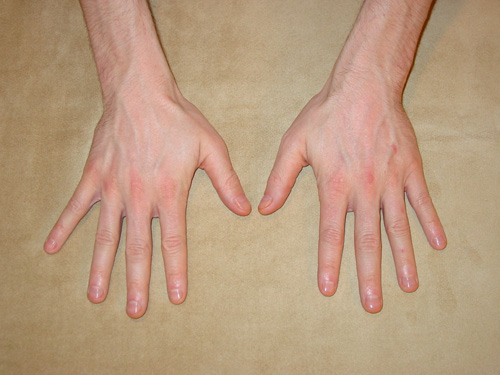 Hand Image